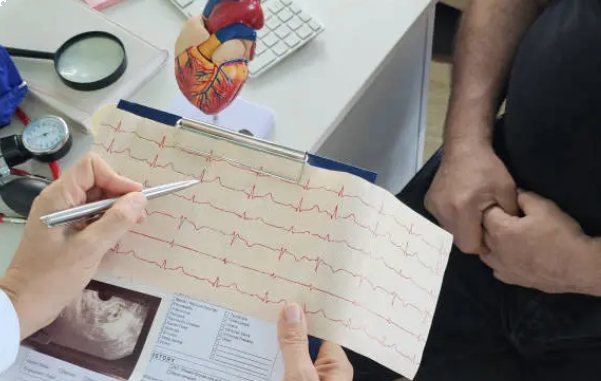 what does an ekg technician do