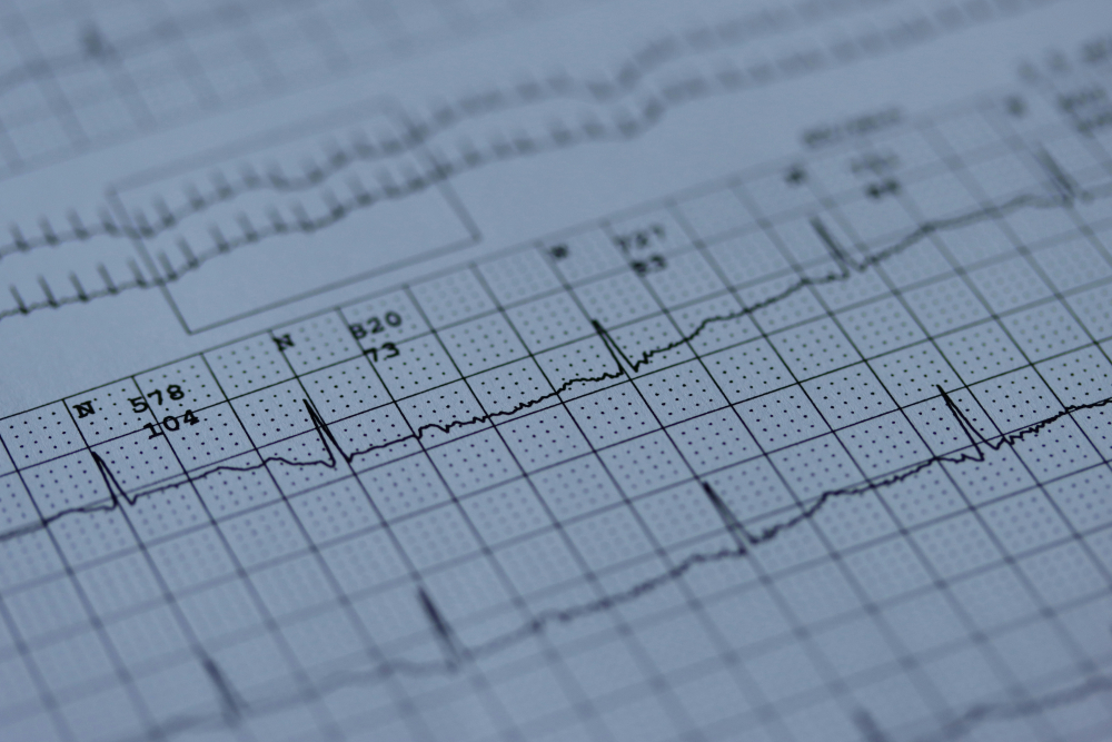 wioa ekg technician training