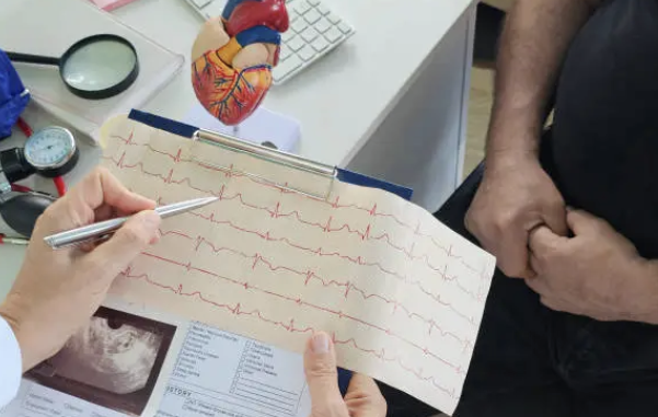what does an ekg technician do