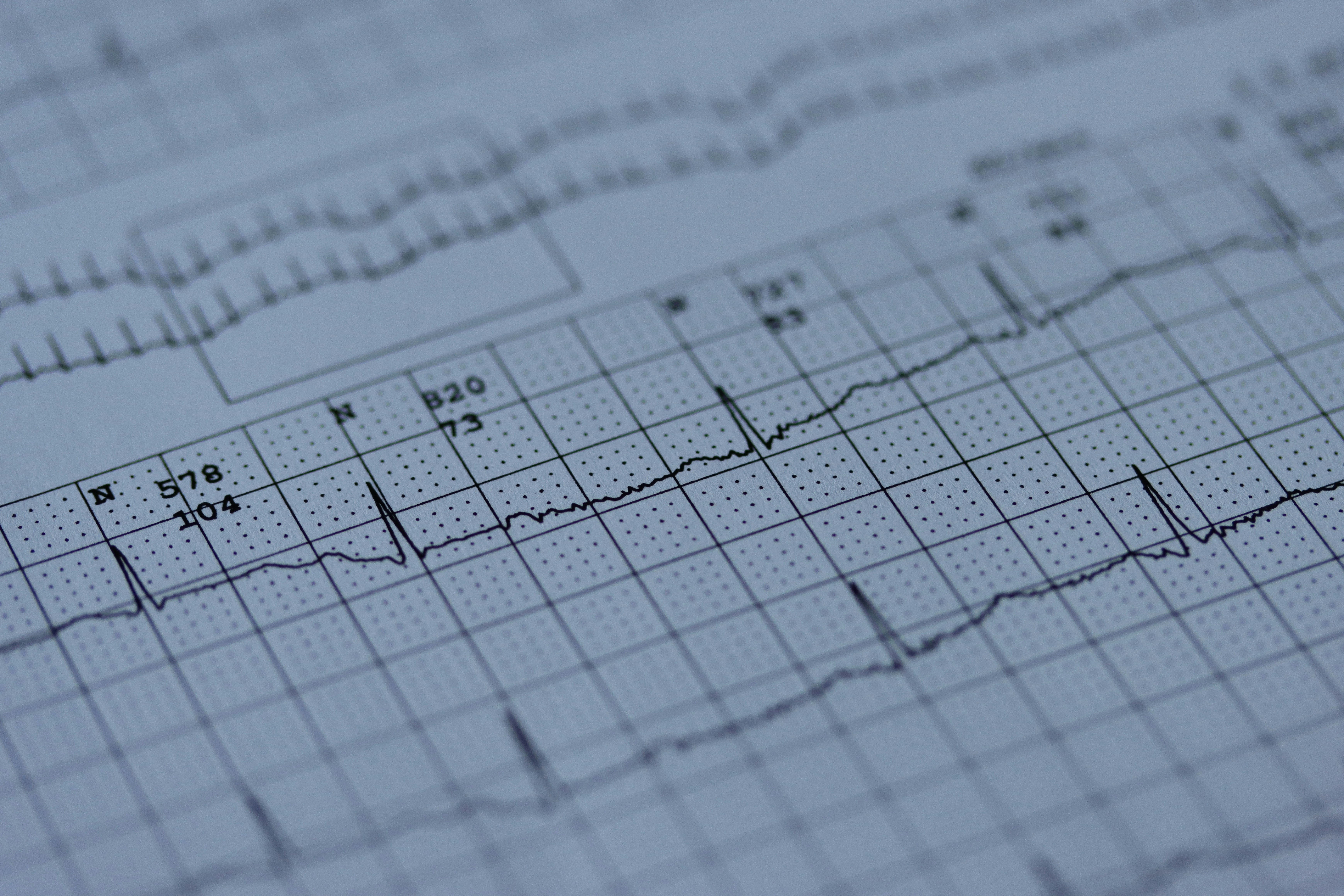 wioa ekg technician training