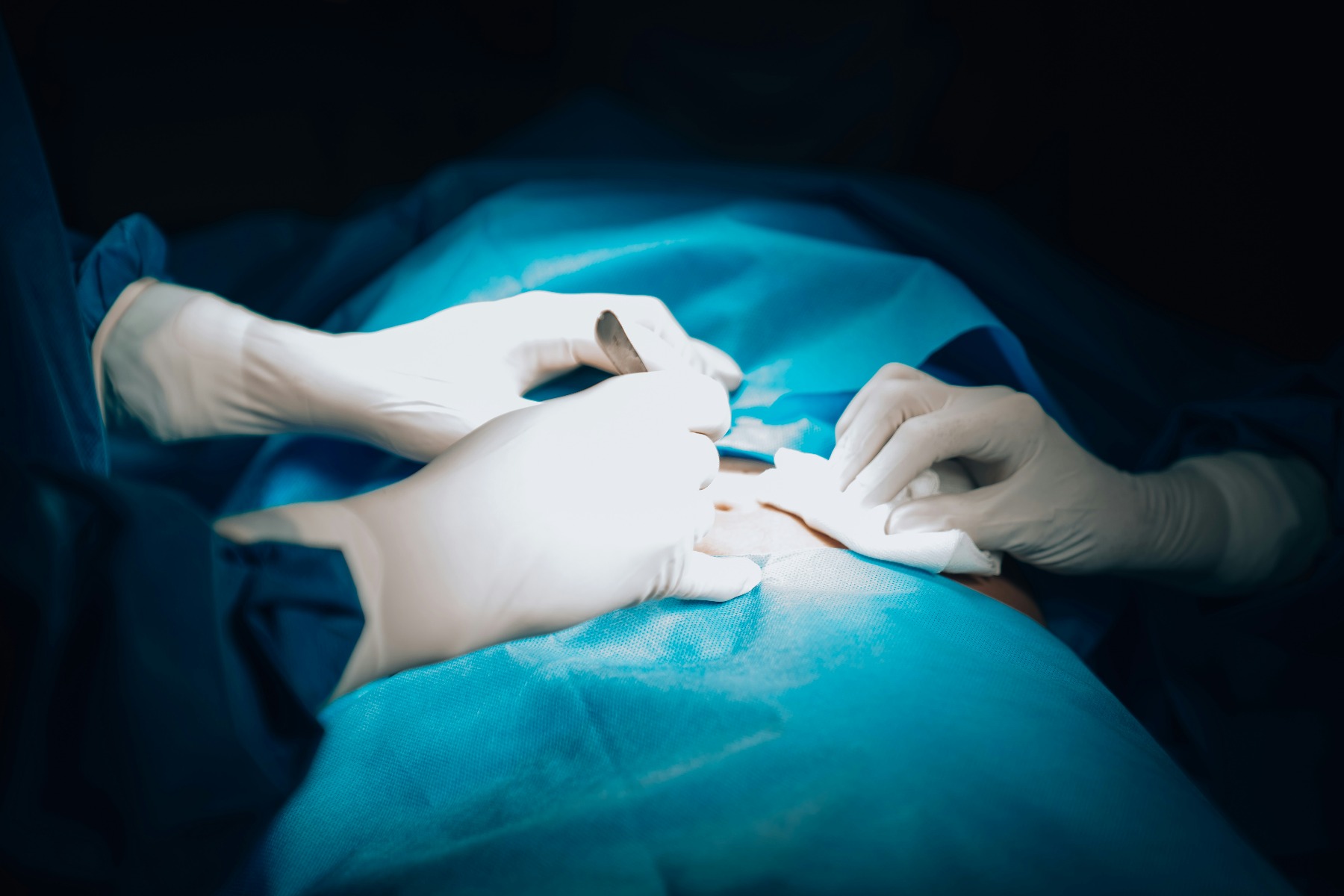 post-operative responsibilities
